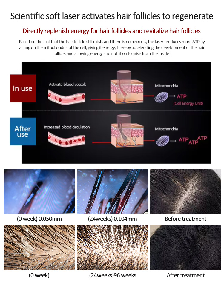 cycle for hair growth