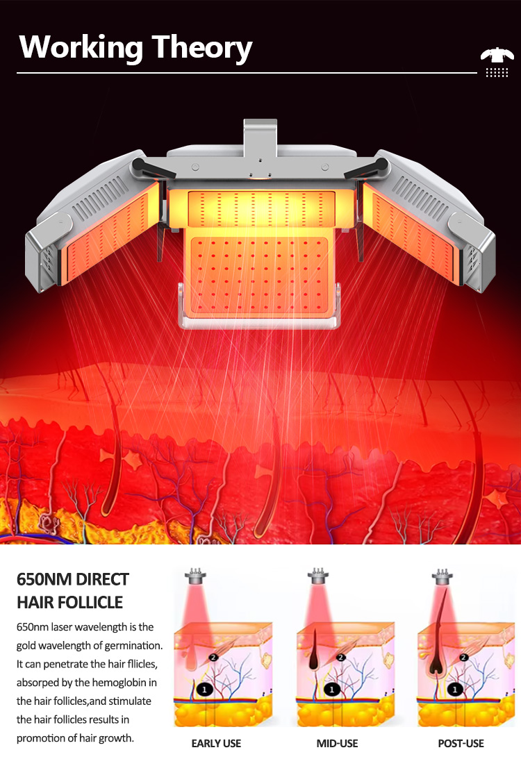 laser hair regrowth