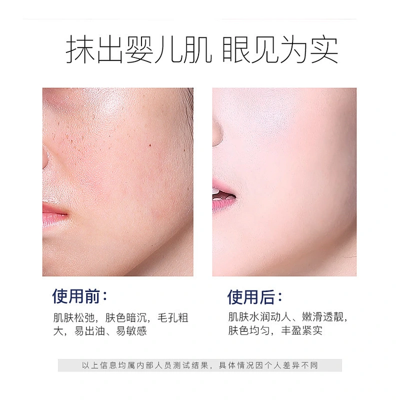 OEM Private label Hyaluronic acid face care set  Polypeptide Nicotinamide whitening skin care sets