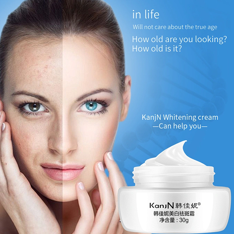 OEM/ODM KanjN Private label anti freckle face cream Melasma removing whitening freckle cream