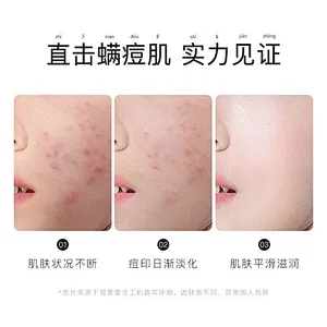 OEM Private label whitening toilet soap organic herbal ginseng sulfur soap