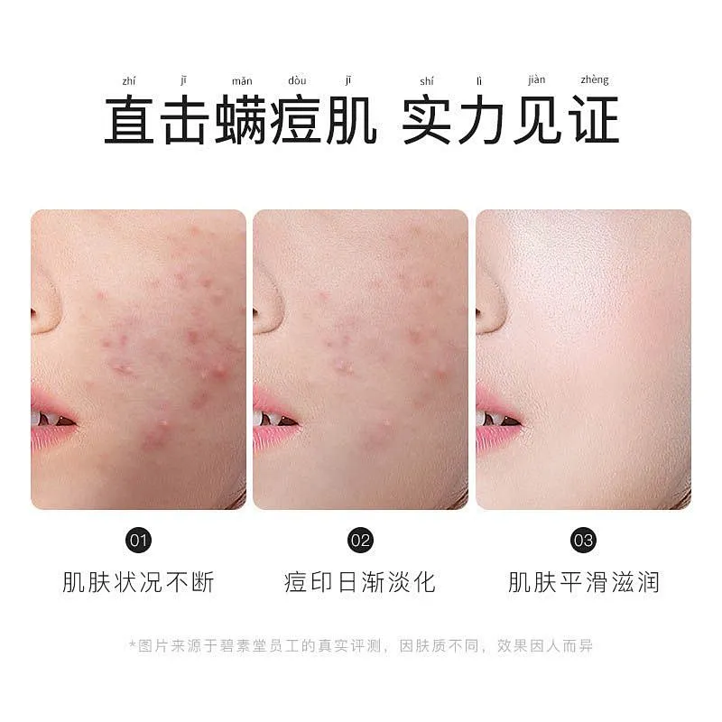 OEM Private label whitening toilet soap organic herbal ginseng sulfur soap