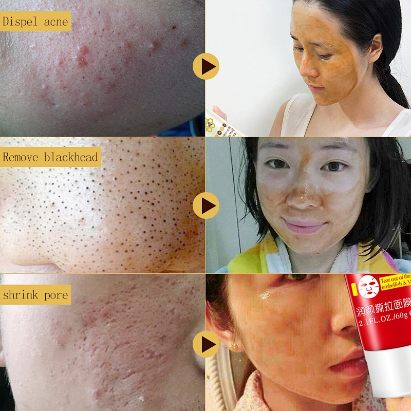 Deep Clean Blackhead Face Mask Acne Treatment Gel Mask Black Head Remover Facial Mask