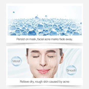 Factory price skin care manufacturer oligopeptide anti aging anti acne face serum
