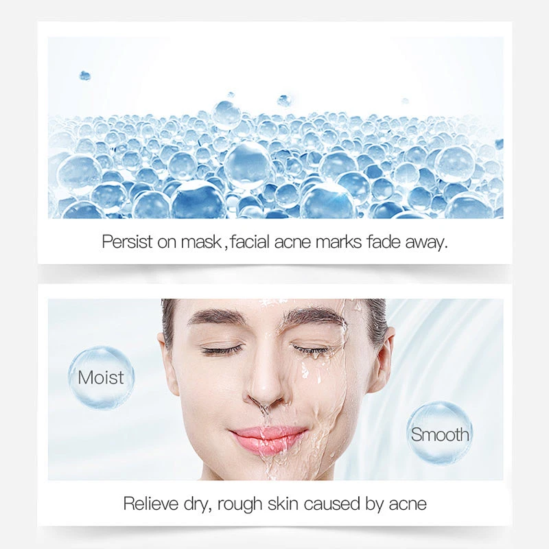 Factory price skin care manufacturer oligopeptide anti aging anti acne face serum