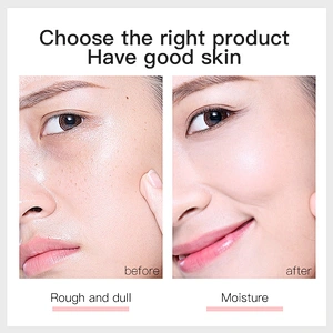 OEM Factory supply natural body scrub helps with stretch marks milk exfoliating scrub
