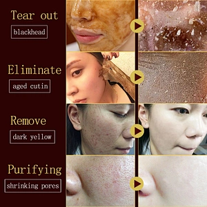 Private label wholesale pore peel off mask pigmentation correctors blackhead remover mask