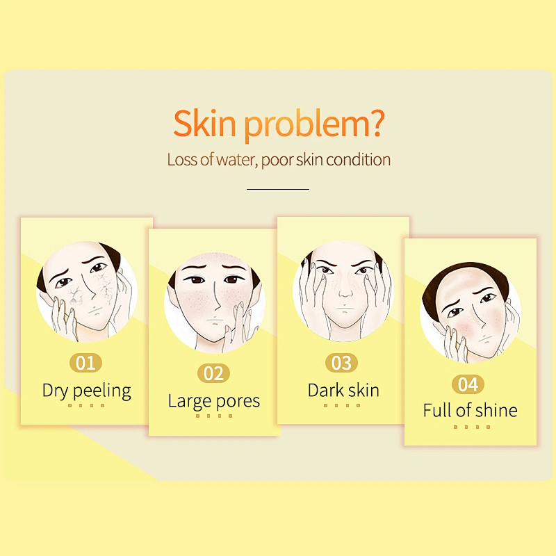 COSHARE Wholesale Acne Treatment Cream Chamomile Repairing Moisturizing Lighting Cream