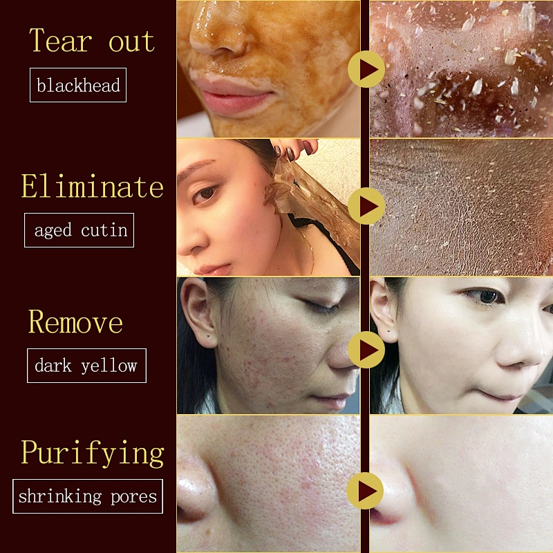 Deep Clean Blackhead Face Mask Acne Treatment Gel Mask Black Head Remover Facial Mask