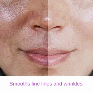 100% Natural Organic Deep Cleansing Exfoliating Dead Sea Mud Mask
