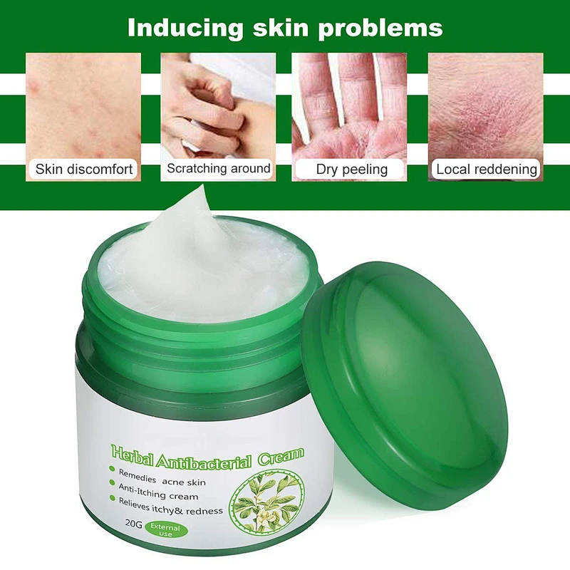 Private Label Herbal Antibacterial Cream Repair Treatment Cream