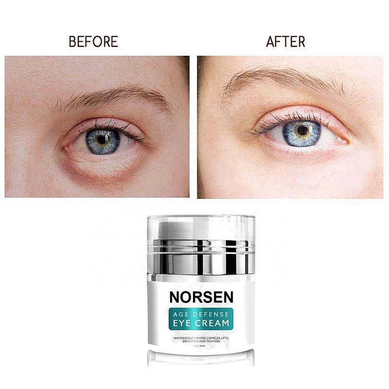 Wholesale eye bag remover anti-aging age defense  eye cream