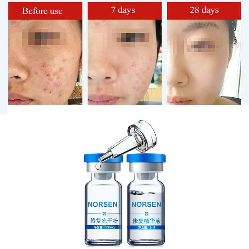 Good effect high quality skin repair lyophilized powder with repair serum