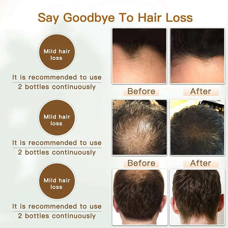 Wholesale High Quality Private Label  Hair Care Hair Serum