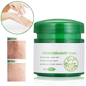 Private Label Herbal Antibacterial Cream Repair Treatment Cream