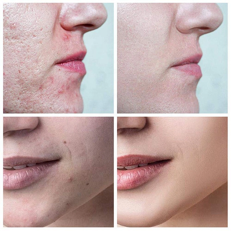 Low price sale good quality whitening jeju canola face mask