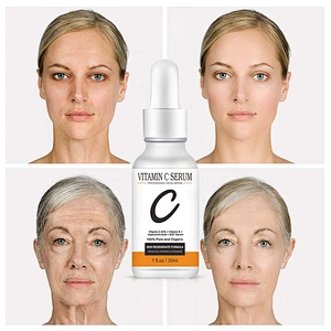 Private Label Natural Organic 20% Vitamin C Anti Aging Wrinkles Vitamin C Serum