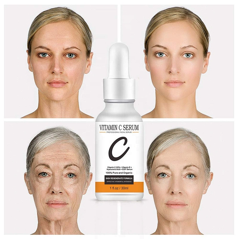 Private Label Natural Organic 20% Vitamin C Anti Aging Wrinkles Vitamin C Serum