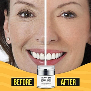 Hot Sale Retinol Face Cream To Reduces Appearance Of Wrinkles Moisturizing And Fine Lines