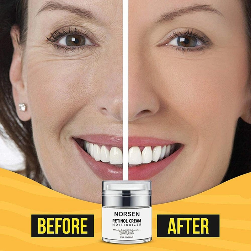 Hot Sale Retinol Face Cream To Reduces Appearance Of Wrinkles Moisturizing And Fine Lines