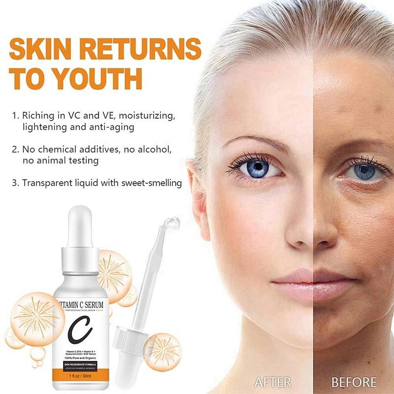 Private Label Natural Organic 20% Vitamin C Anti Aging Wrinkles Vitamin C Serum