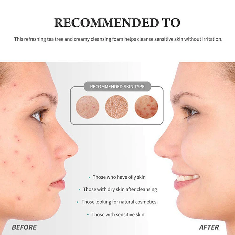 Wholesale Natural Organic Face Care Oil Control Whitening Facial Cleanser