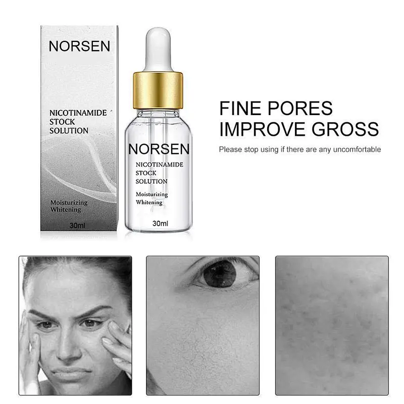 Wholesale Private Label Whitening Moisturizing Nicotinamide Serum