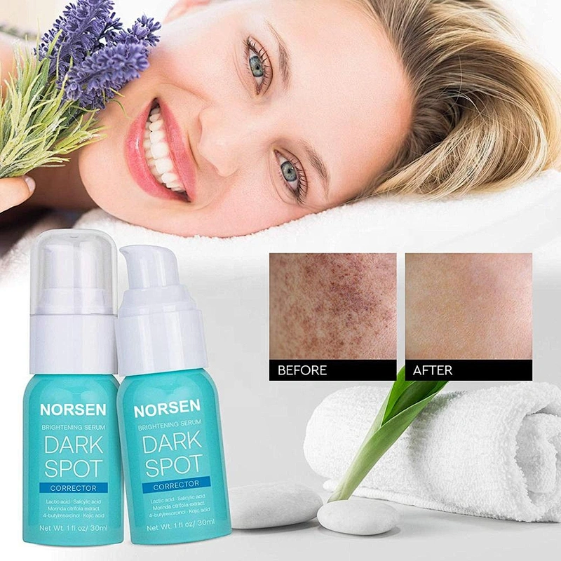Hot private label new product custom brightening serum dark spot corrector