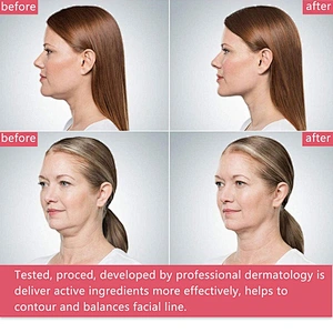 OEM Private Label Lifting V Shaped Slimming Face Mask For Moisture Hydration