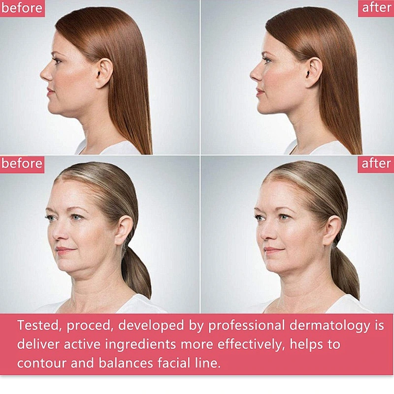 OEM Private Label Lifting V Shaped Slimming Face Mask For Moisture Hydration