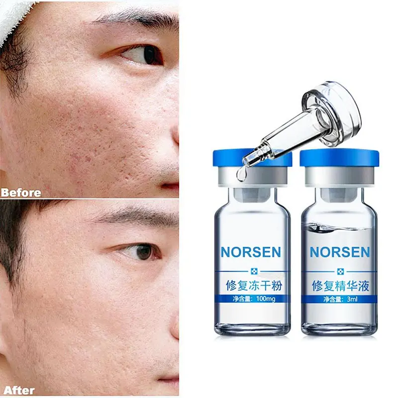 Good effect high quality skin repair lyophilized powder with repair serum