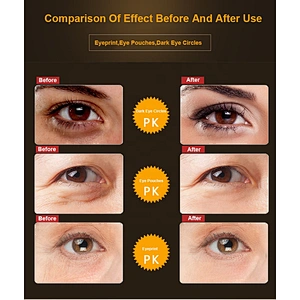 Hot Sales High Quality Private Label Caviar Eye Care Set