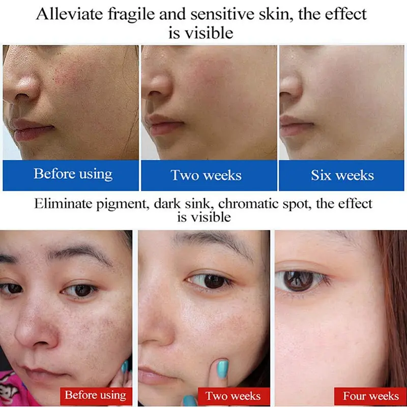 Good effect high quality skin repair lyophilized powder with repair serum