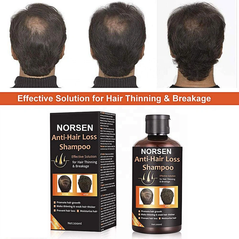 Natural Organic Plant Anti-Hair Loss Shampoo for Thinning Hair