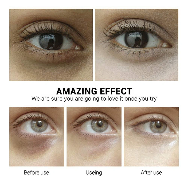 Professional manufacturer supply hyaluronic acid eye mask for reduces dark circles and eyebags