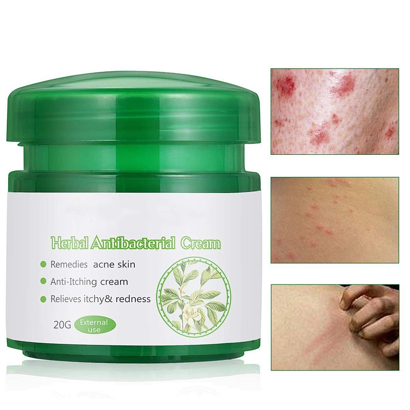 Private Label Herbal Antibacterial Cream Repair Treatment Cream