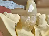 dental zirconia block