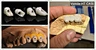 High strength zirconia disc