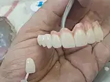 98mm 3d multilayer dental material zirconia block