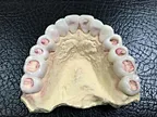 Flexible PMMA Acetal Disc Block