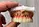 Teeth and gum shade