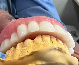 Teeth and gum shade