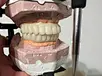 Dental PMMA material