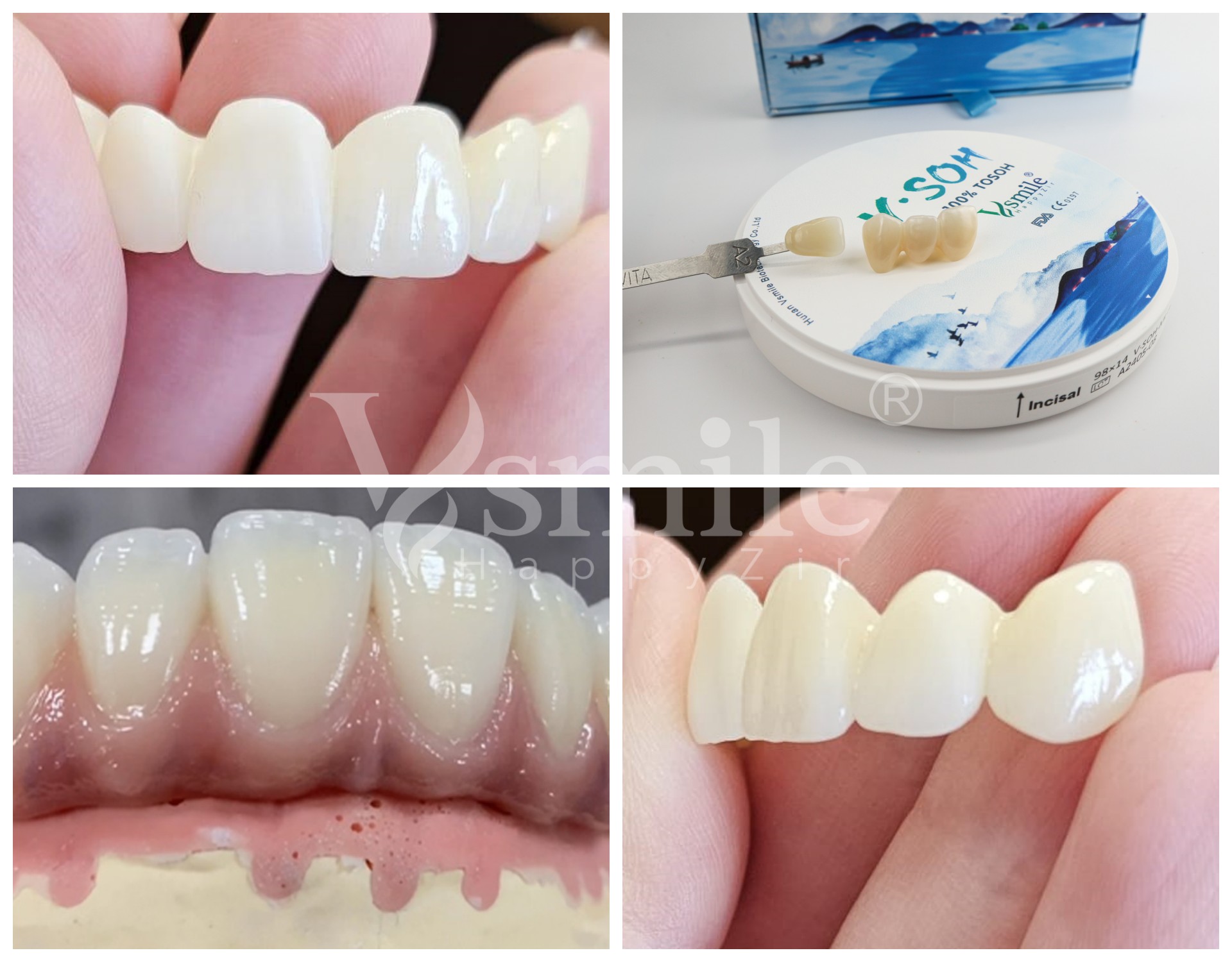 3D multilayer dental block