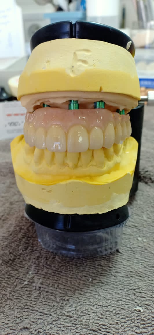 ST colored zirconia