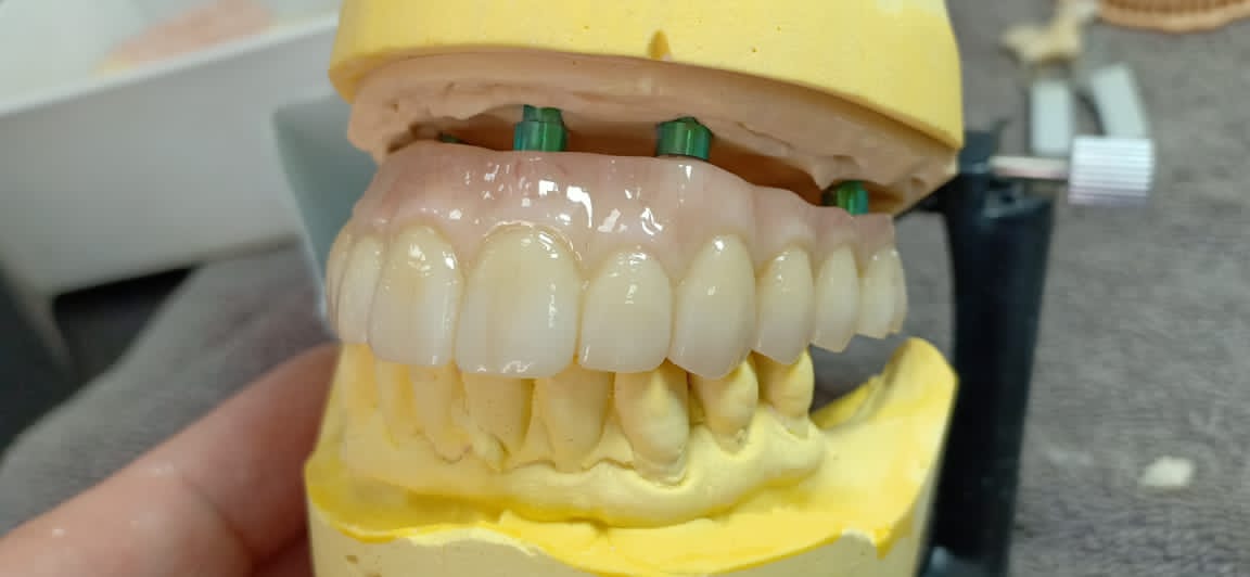 ST colored zirconia
