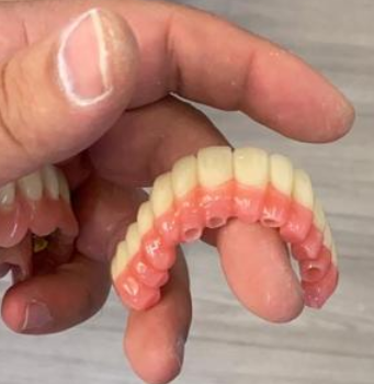 Full Denture Double Layer PMMA