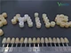 alloy restorations dental