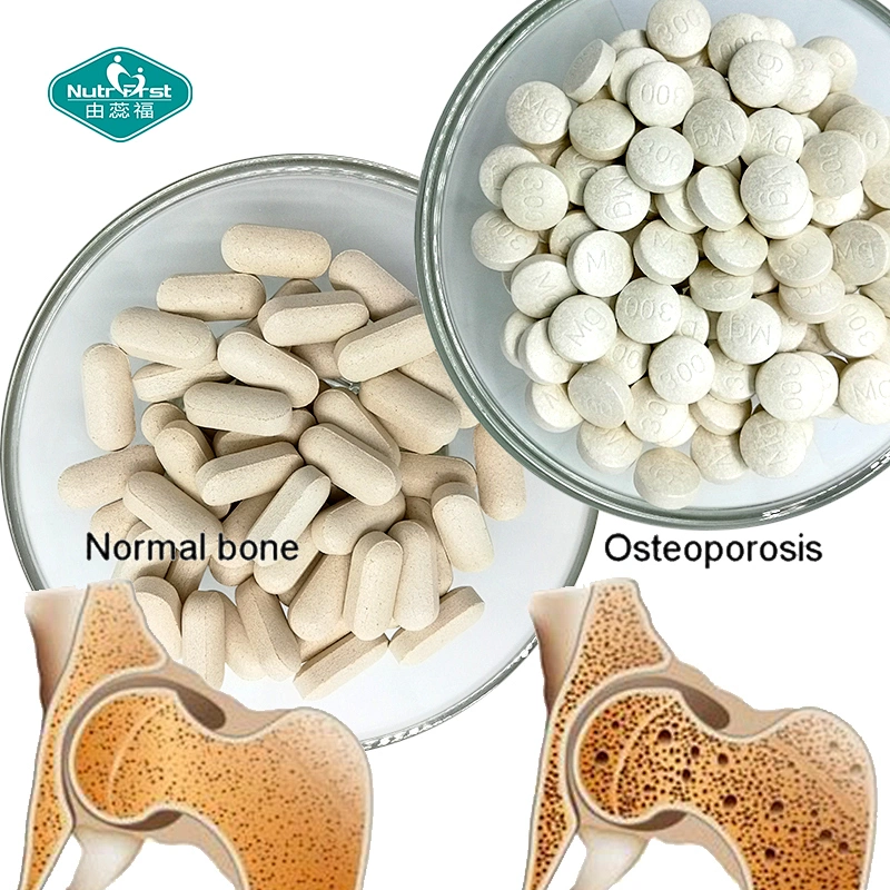 Private Label Joint Support Supplement Pill Glucosamine MSM Tablet Supplier Chondroitin for Knee Joint Pain Relief
