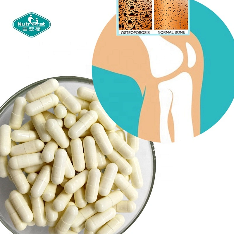 Suplementos de densidad ósea con etiqueta personalizada, cápsulas de metilsulfonilmet, polvo de MSM, píldora de cúrcuma para soporte articular